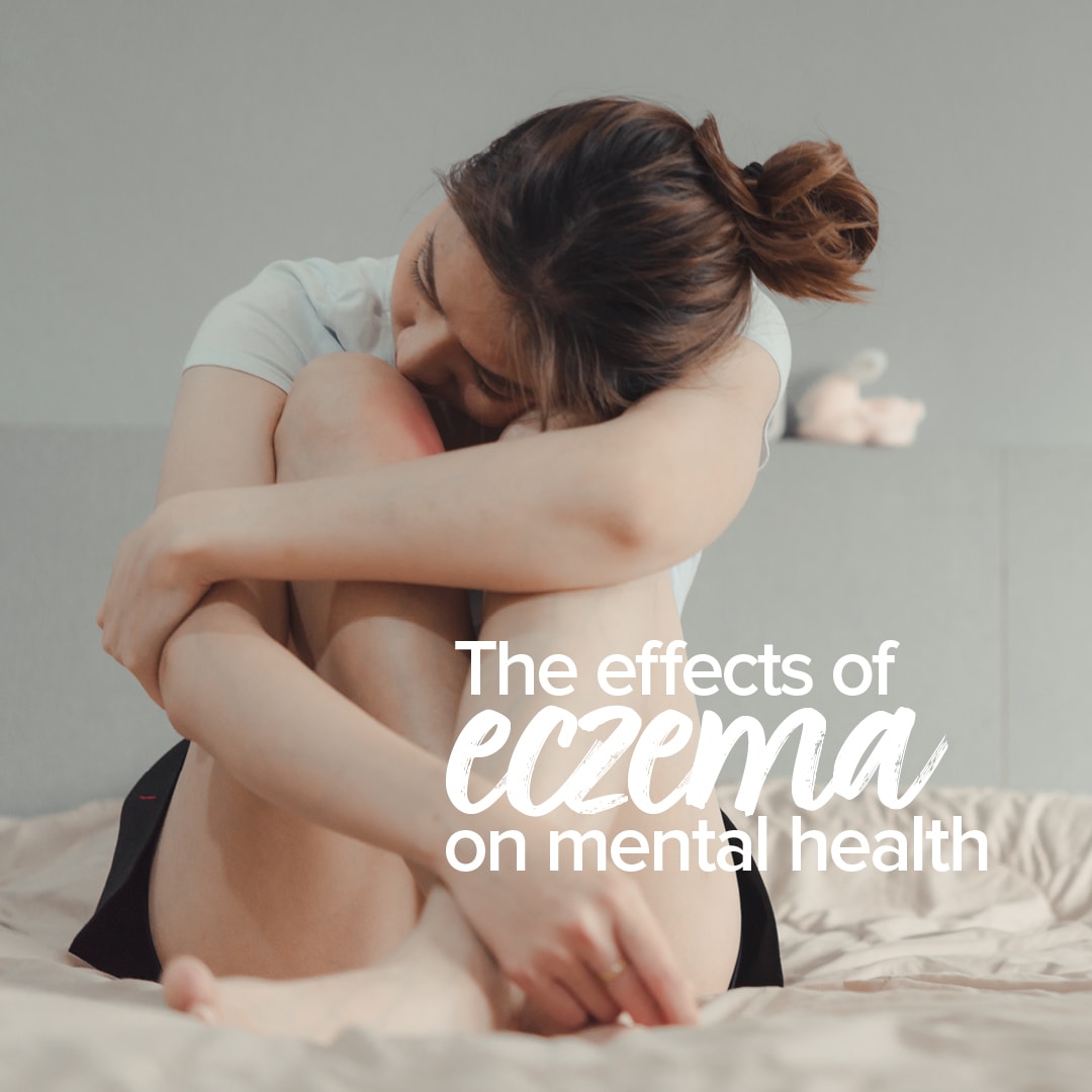 a young woman sitting hugging her arms around her crossed legs and her head resting down on her knees. The caption on the image reads " The effects of eczema on Mental Health"