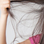 Oral Contraceptives & Hair Loss
