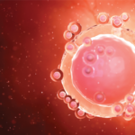 Hope on the Horizon for PCOS