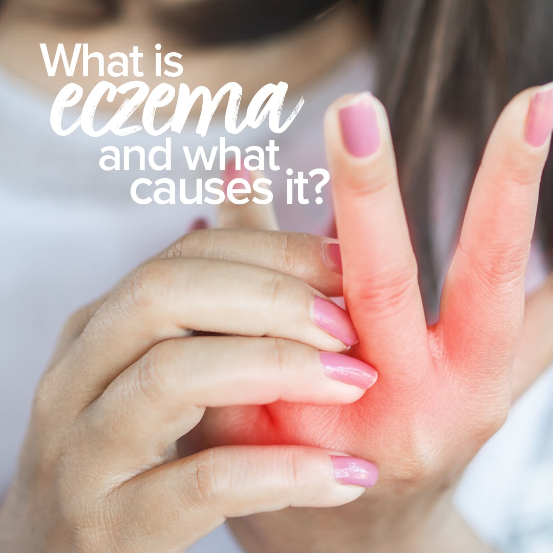 a woman's hands. she is scratching one that looks very red. The text over the image reads " What is eczema and what causes it?"