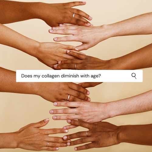 The hands of 4 women. They are from multiple backgrounds. There is a search bar over the image that reads" Does my collagen diminish with age?"