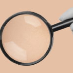 A Guide to Moles & Freckles