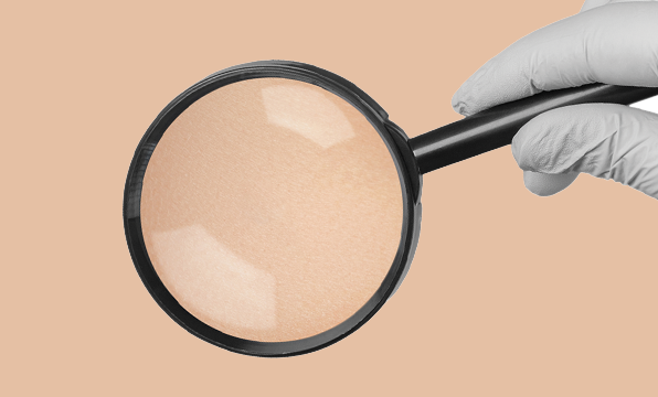 A Guide to Moles & Freckles